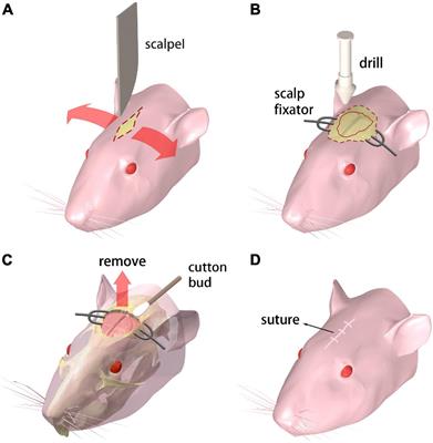 A Skull-Removed Chronic Cranial Window for Ultrasound and Photoacoustic Imaging of the Rodent Brain